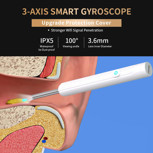 Smart Visual Ear Cleaner with Camera 1296P